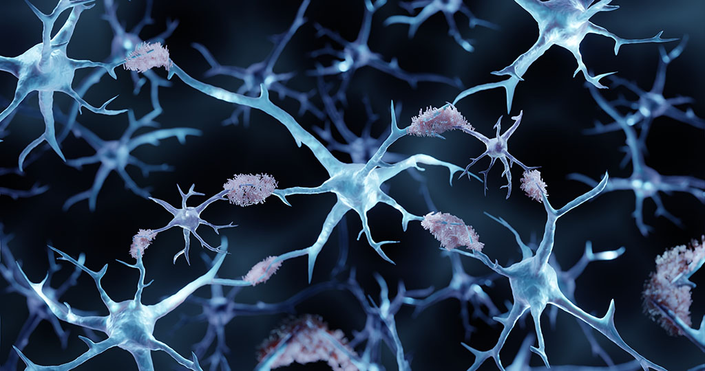 Brain disorders illustration