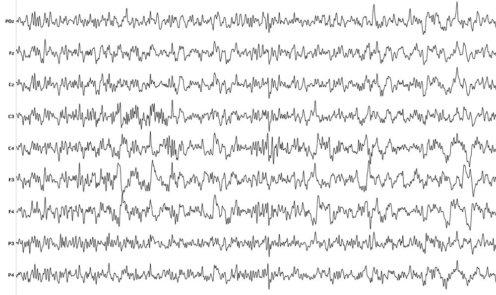 EEG signal mapping