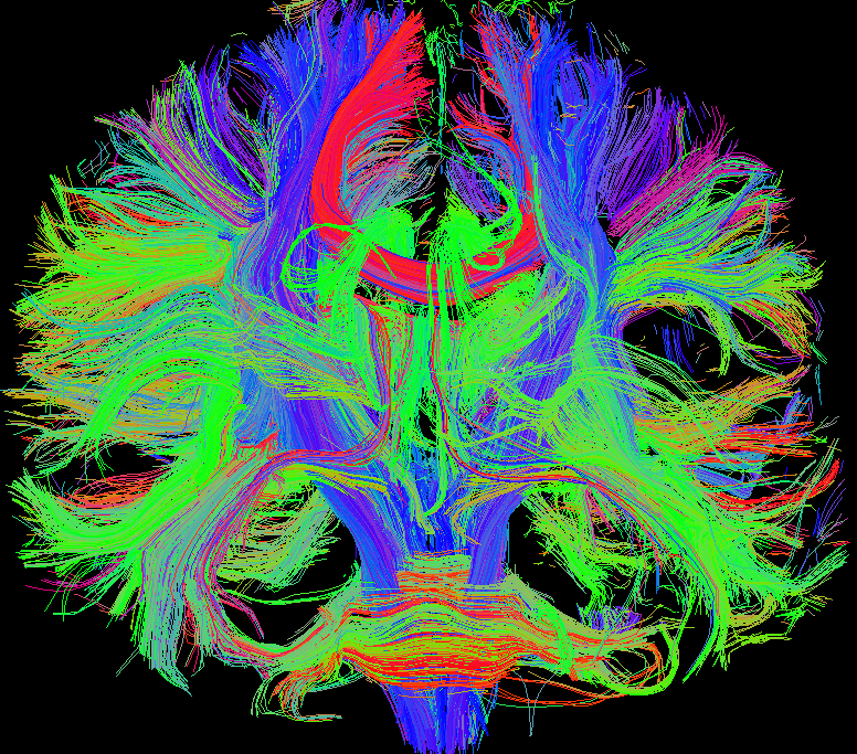 Diffusion Tensor Imaging mapping